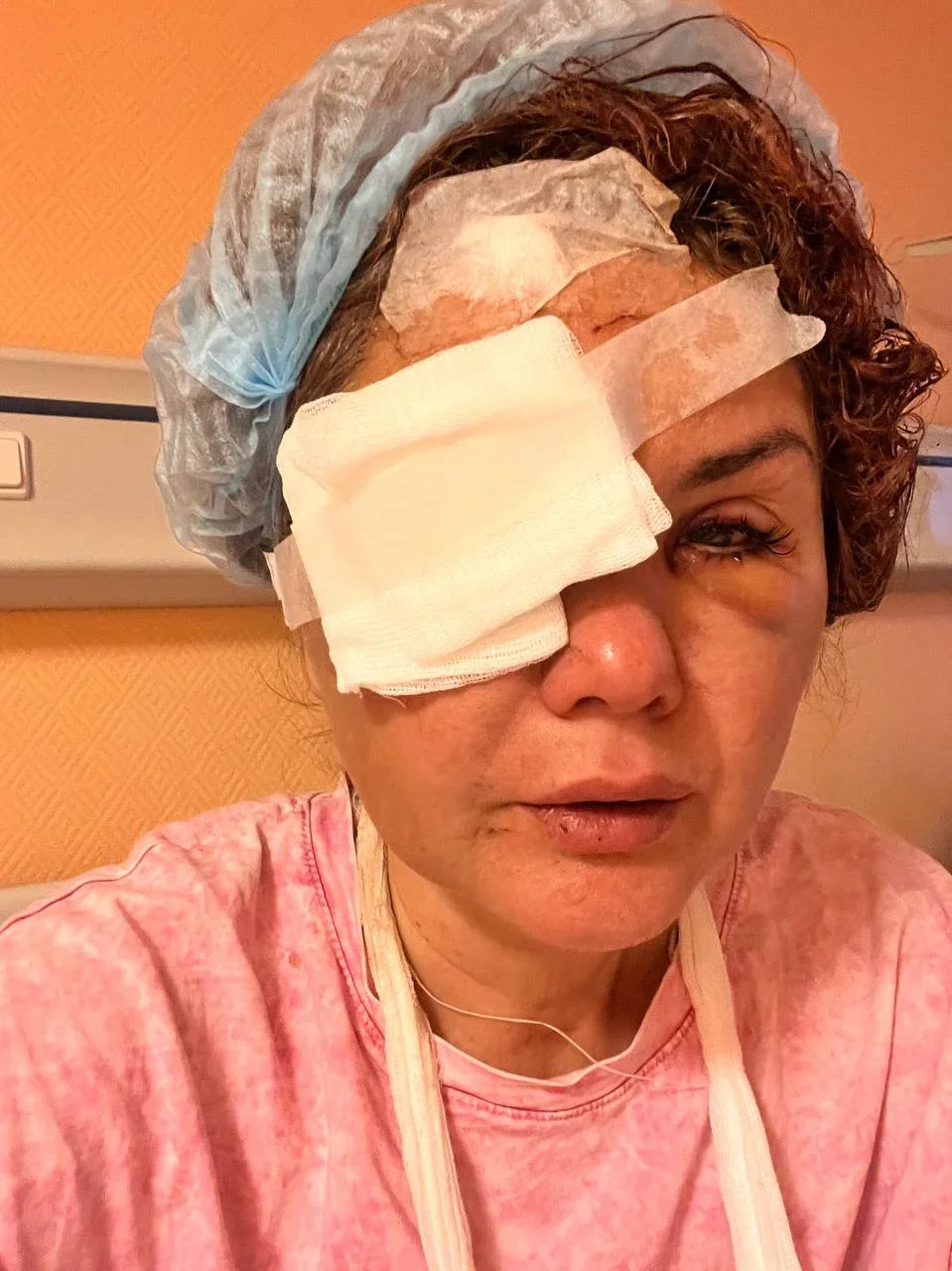 Ksenia Dushanova following the assault, photo: Telegram