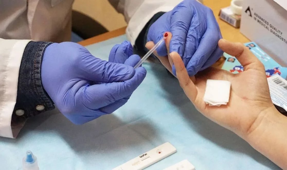 An HIV test being administered. Photo: Revda Info